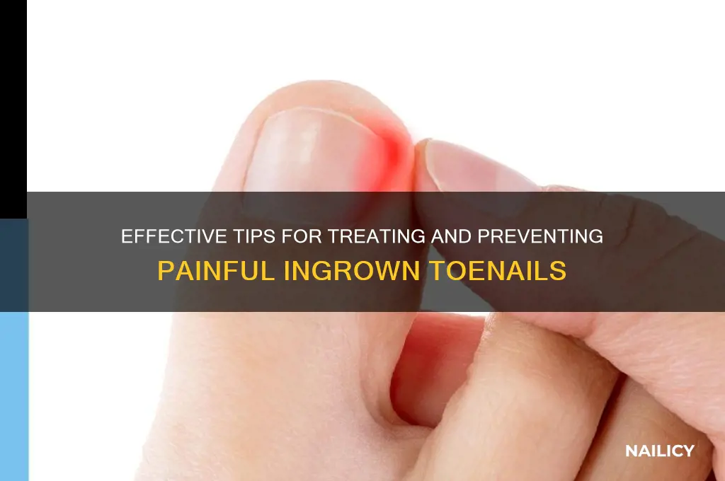how to deal with a ingrown nail