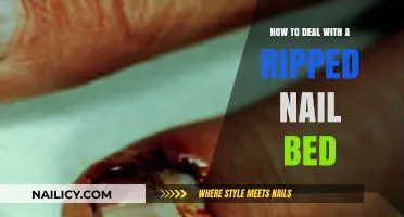 Quick Relief: Healing and Caring for a Ripped Nail Bed