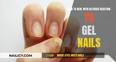 Gel Nails Allergy: What to Do and How to Prevent It