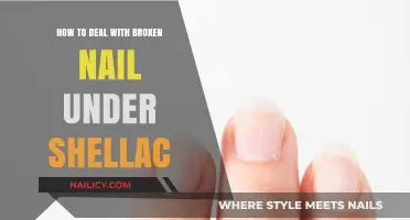 Quick Fixes for Broken Nails Under Shellac: Repair and Restore