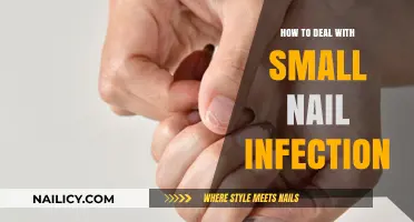 Effective Ways to Treat and Prevent Minor Nail Infections at Home