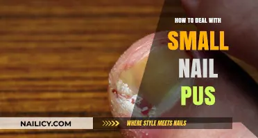 Effective Ways to Treat and Prevent Small Nail Pus at Home