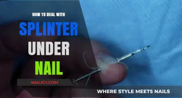 Painful Splinter Under Nail? Quick and Safe Removal Tips