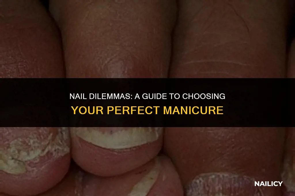 how to decide what nails to get