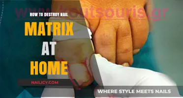 Safe and Effective Ways to Remove Nail Matrix at Home