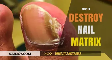 Effective Methods to Permanently Destroy the Nail Matrix Safely