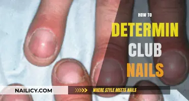Identifying Clubbed Nails: A Comprehensive Guide to Diagnosis and Causes