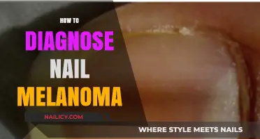 Identifying Nail Melanoma: Essential Steps for Early Diagnosis and Treatment