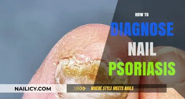 Identifying Nail Psoriasis: Symptoms, Diagnosis, and Treatment Options Explained
