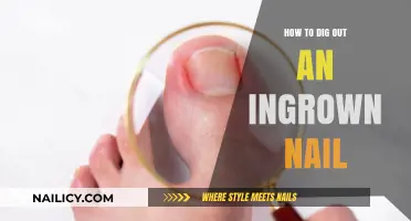 Effective Steps to Safely Treat and Prevent Ingrown Nails at Home