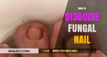 Conceal Fungal Nail Infections: Effective Tips for Disguising Discolored Toenails