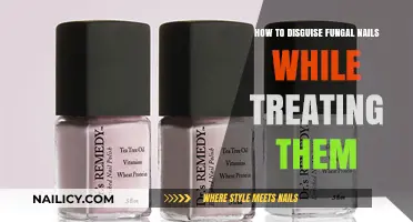 Conceal and Heal: Effective Ways to Disguise Fungal Nails During Treatment