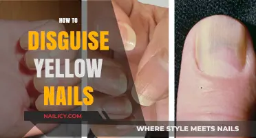 Conceal Yellow Nails: Easy Tips for a Natural, Healthy Look