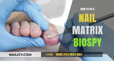 Mastering Nail Matrix Biopsy: A Step-by-Step Guide for Professionals