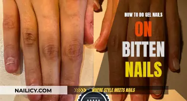 Gel Nails: Transforming Bitten Nails into a Stylish Manicure