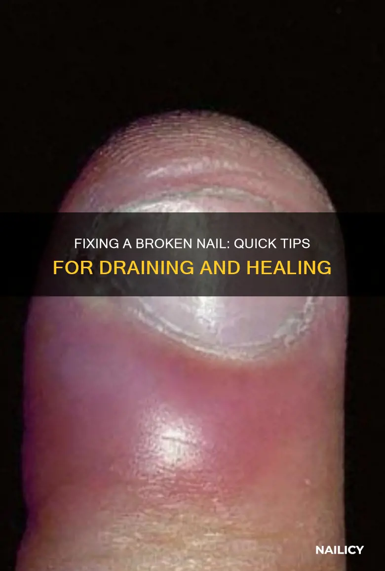 how to drain a smashed finger nail