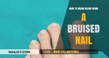 Effective Steps to Drain Blood from a Bruised Nail Safely