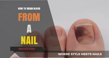 Quick Relief: Safe Steps to Drain Blood from a Nail
