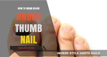 Quick Relief: Draining Blood Under Your Thumb Nail Safely