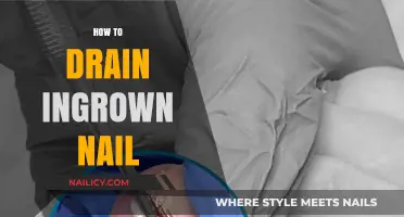Effective Steps to Safely Drain and Treat Ingrown Toenails at Home