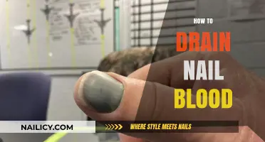 Quick and Safe Methods to Drain Blood from a Nail
