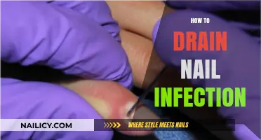 Effective Steps to Drain and Treat Nail Infections Safely at Home