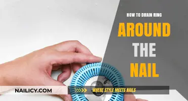 Effective Ways to Drain and Treat a Painful Nail Ring