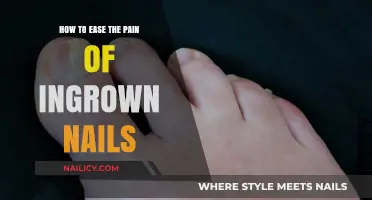 Effective Remedies to Relieve Pain from Ingrown Nails Quickly