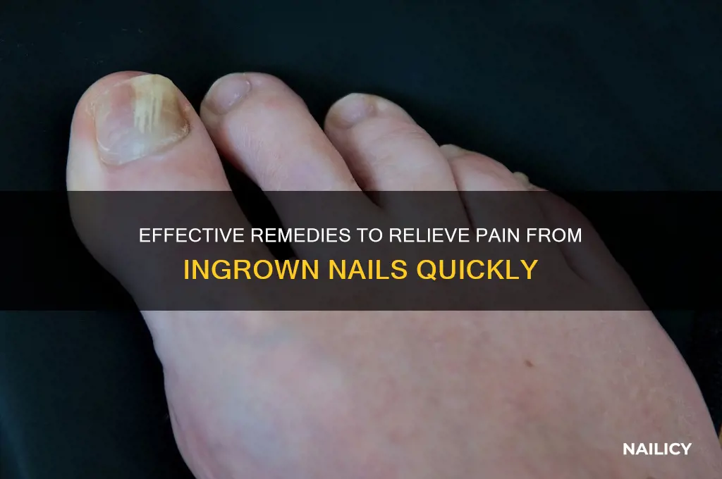 how to ease the pain of ingrown nails