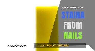 Effective Tips to Remove Yellow Stains from Nails Naturally