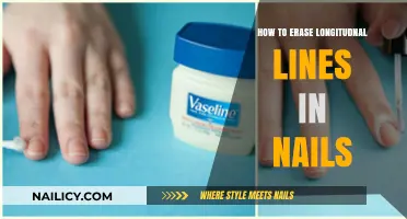 Erase Longitudinal Nail Lines: Effective Tips for Smooth, Healthy Nails