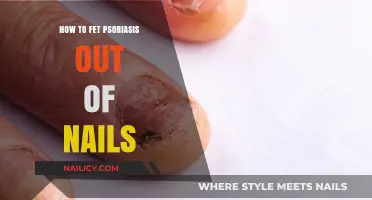 Effective Tips to Clear Psoriasis from Your Nails Naturally