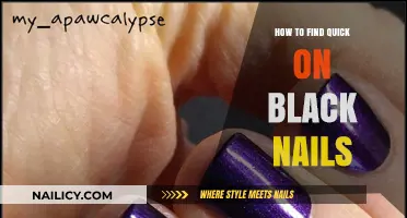 Quick Fixes for Black Nails: Tips and Tricks to Find Relief