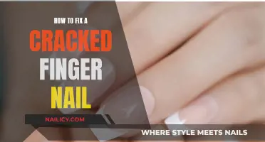 Nail Repair: Quick Tips for Fixing a Cracked Fingernail