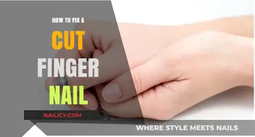 Fixing a Cut Fingernail: Quick and Easy Steps
