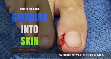 Fixing an Ingrown Nail: Step-by-Step Guide