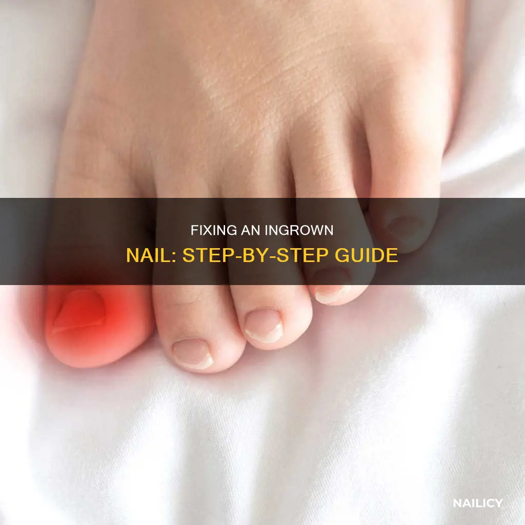 how to fix a nail growing into skin