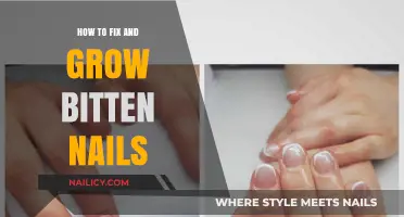 Fixing Bitten Nails: A Guide to Healthy Hands