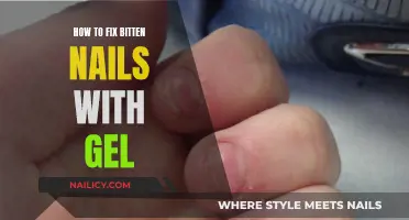 Gel Nails: A Quick Fix for Bitten Nails