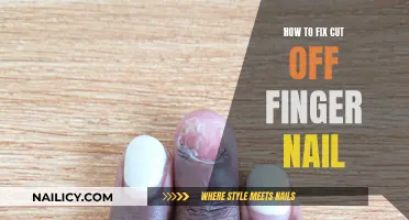 Fixing Cut Fingernails: Quick Home Remedies