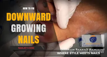 Repairing Nails: A Guide to Fixing Downward Growing Nails