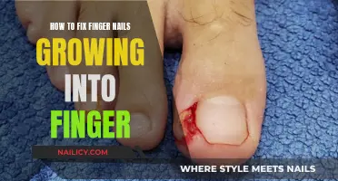 Fixing Ingrown Nails: Tips for Healthy Fingers