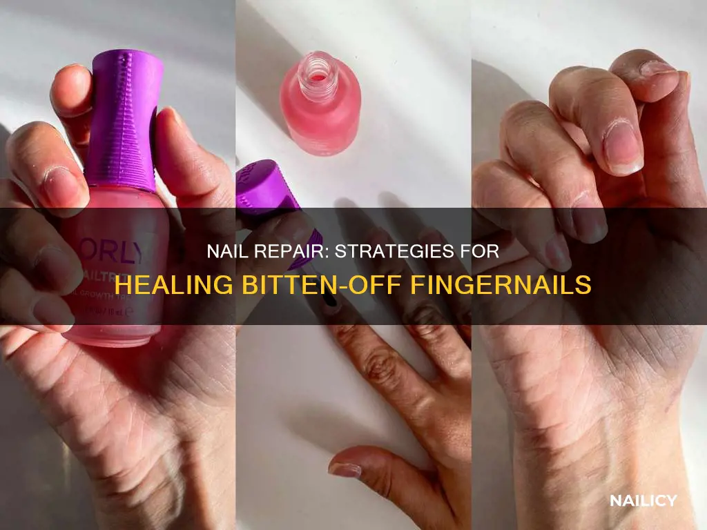 how to fix finger nails that have been bitten off