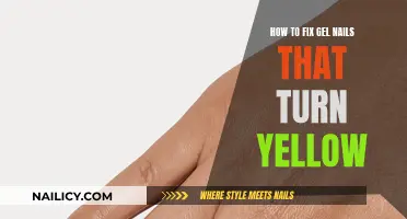 Gel Nails Turning Yellow? Here's How to Fix It