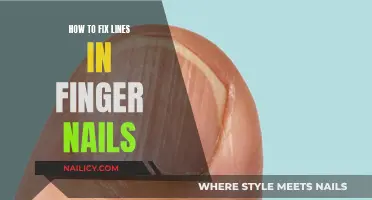 Repairing Ridges: Fixing Lines on Your Fingernails