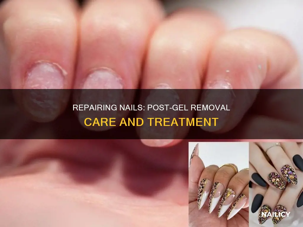 how to fix nails after picking off gel