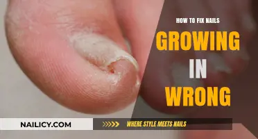 Fixing Ingrown Nails: Tips and Tricks