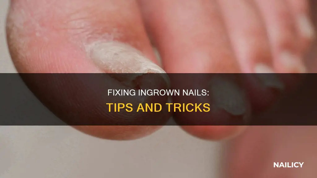 how to fix nails growing in wrong