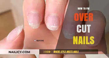 Repairing Over-cut Nails: Quick and Easy Solutions