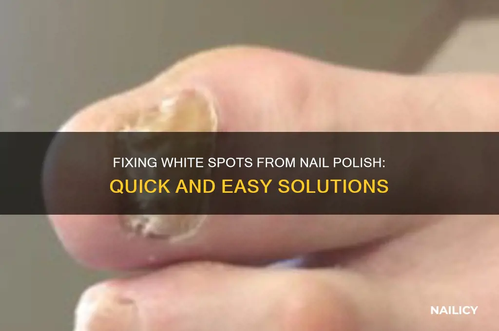 how to fix white spots from nail polish